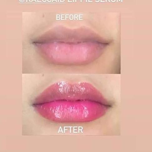 ✲ raecca lippie serum ➱