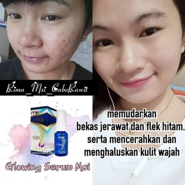 Serum glowing