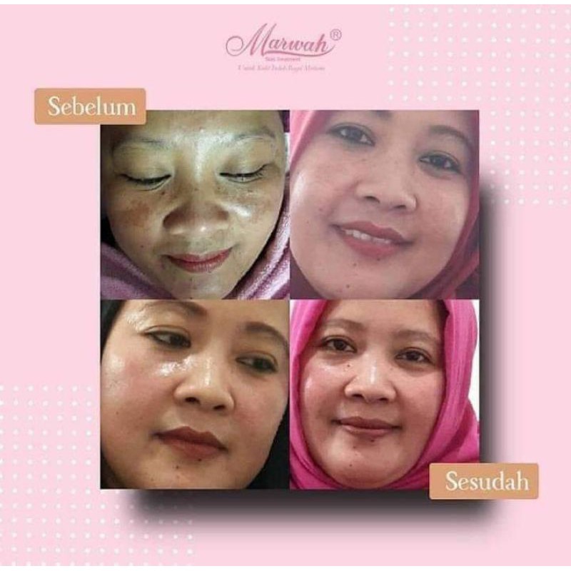 Skincare Marwah