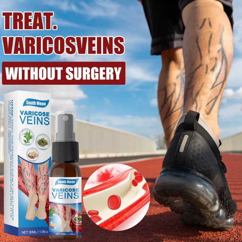 varicose veins spray
