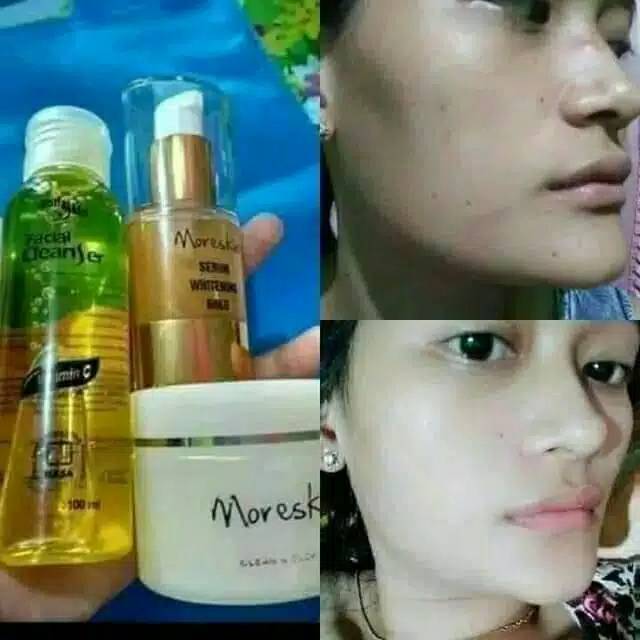 Paket glowing