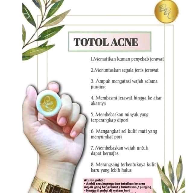Totol acne/jerawat