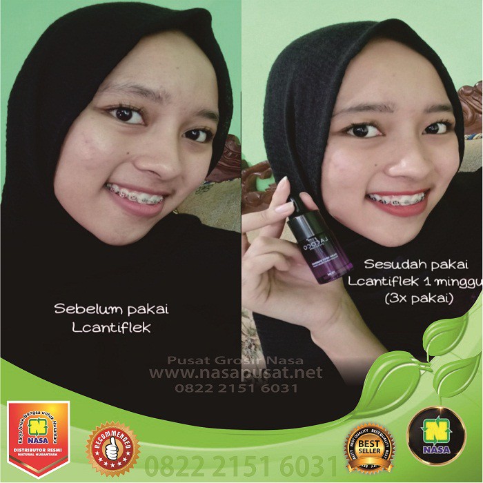 Serum Anti Bekas Jerawat