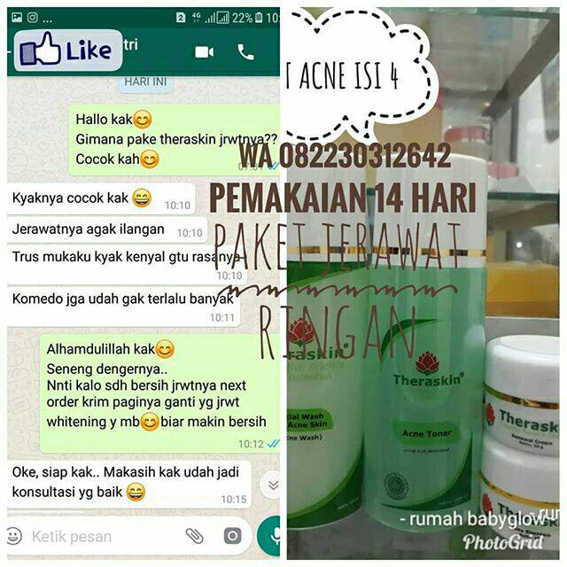 theraskin paket jerawat ringan