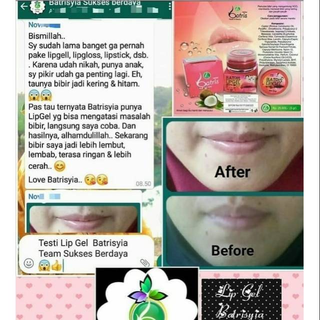 Lip gel