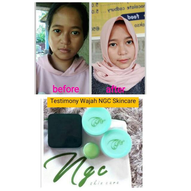 NGC skincare