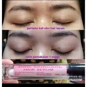 serum bulu mata dan alis tipis