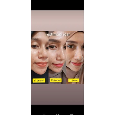 JOAR SKINCARE