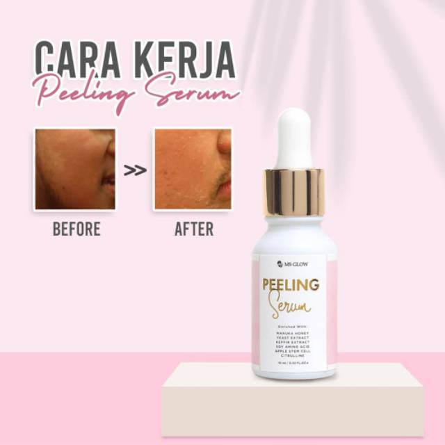 peeling serum MS glow