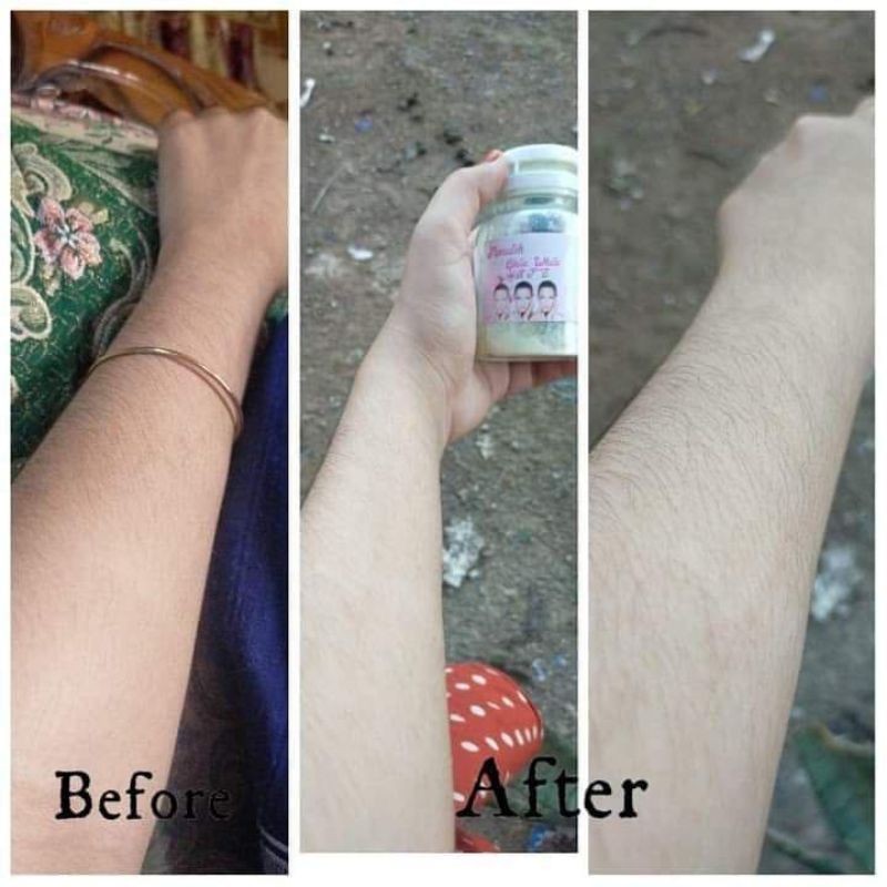 GLUTA WHITE KFS ORIGINAL