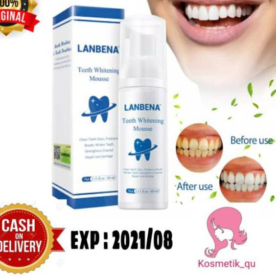 ☟ Lanbena Teeth Whitening Mousse 60Ml ✧