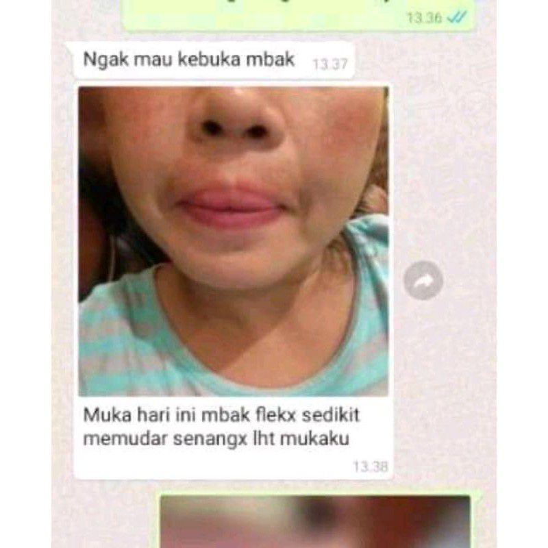 salep flek