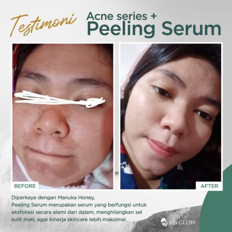PEELING SERUM msglow
