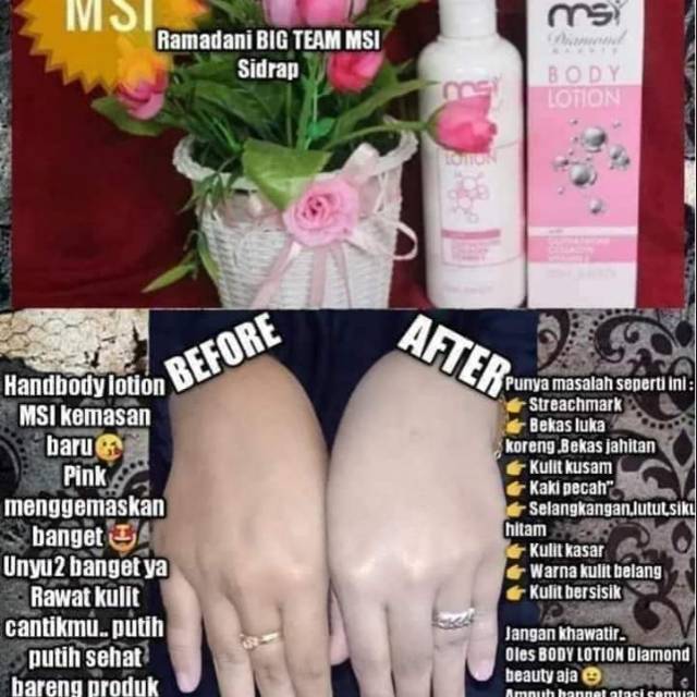 HB Diamond MSI