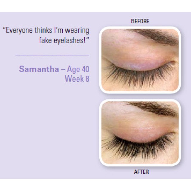 Rapidlash Eyelash & Eyebrow Enhancing Serum