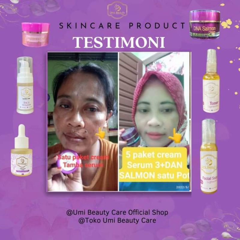 UBC Cream