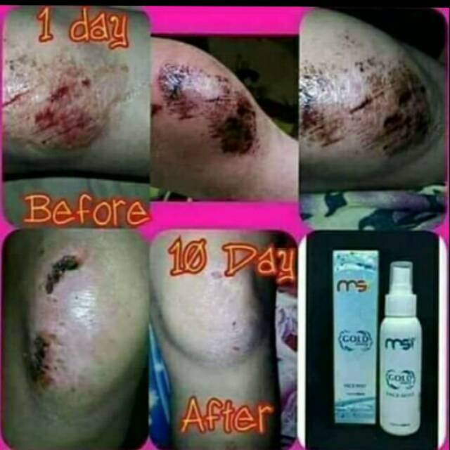FACE MIST MSI 100% ORI