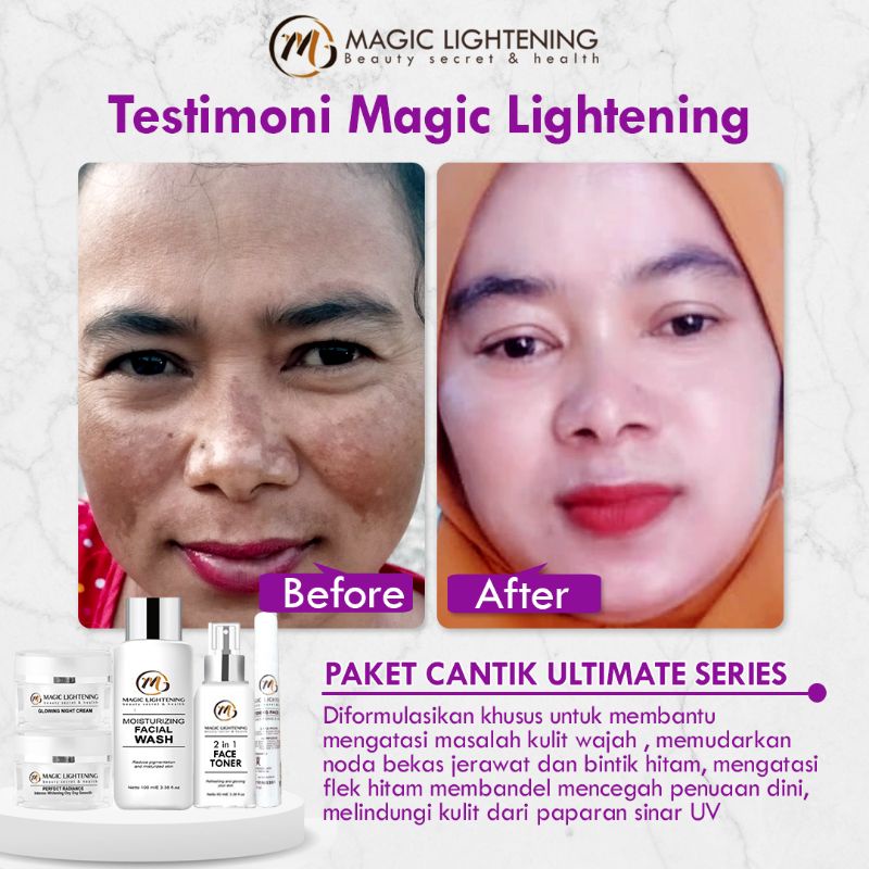 PAKET PERAWATAN CANTIK BASIC  GLOWING, FLEK & ACNE MAGIC LIGHTENING