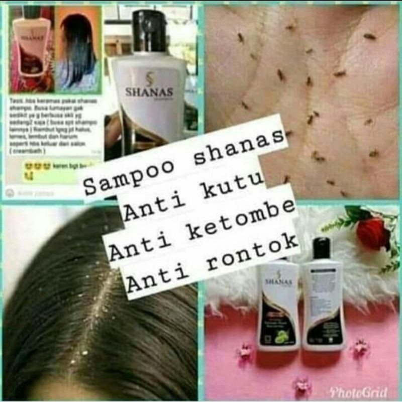 Shampo kutu