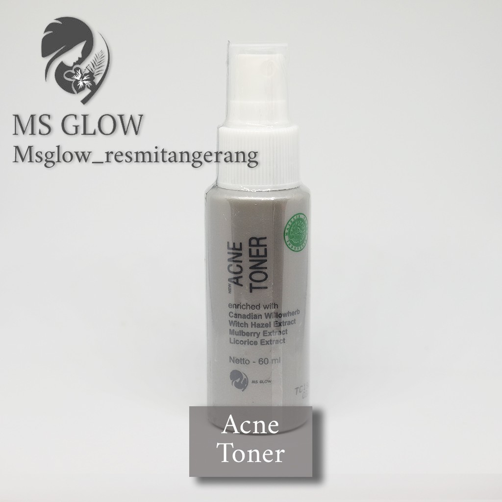ACNE TONER