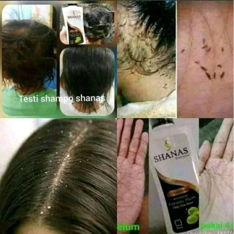 shanas