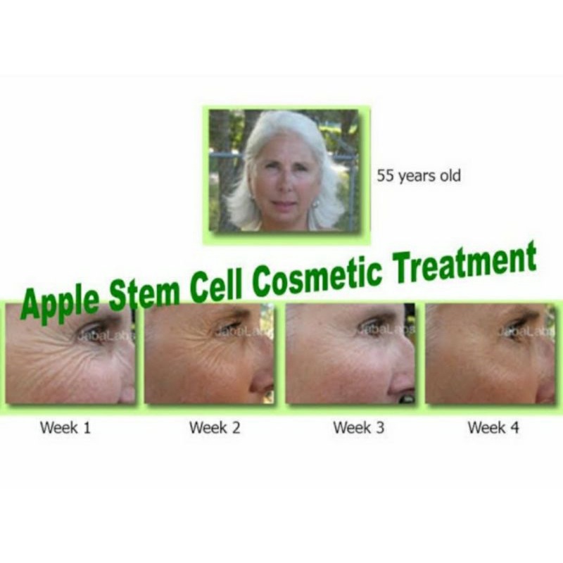 Apple Stem Cell /Cosmetic Grade / External Use premium