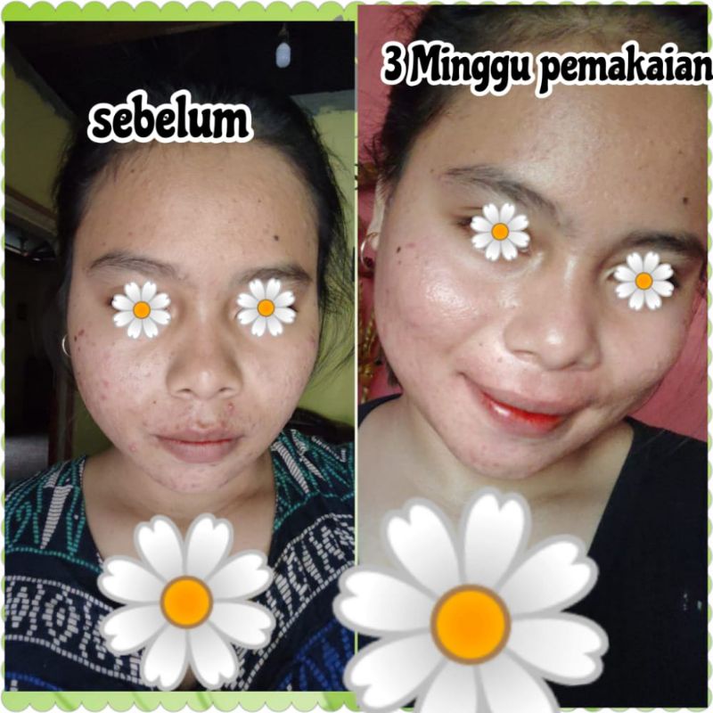 DBC series whitening hemat