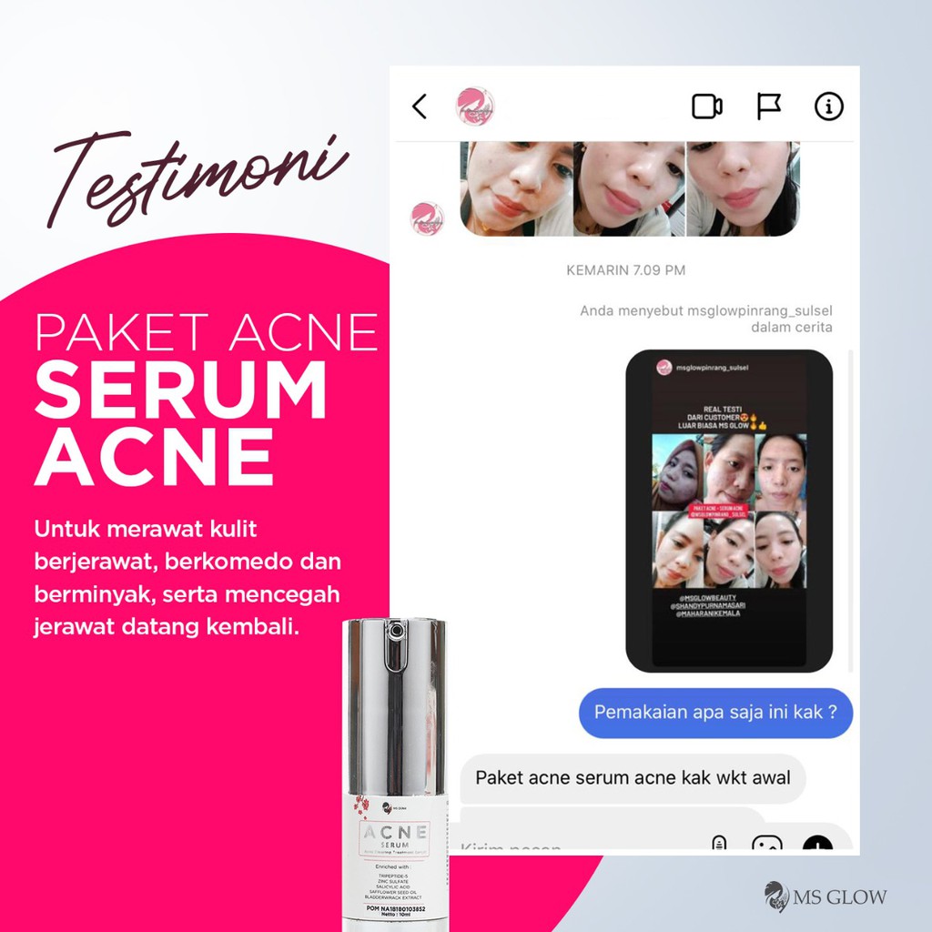 MS Glow Acne Serum