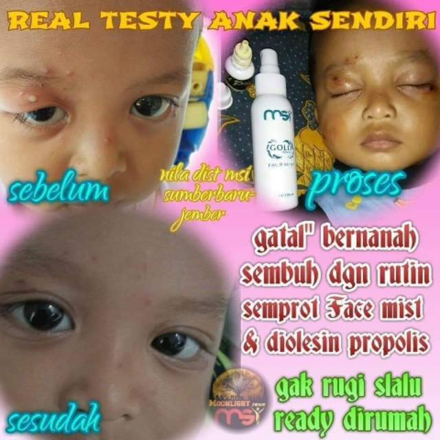 Facemist msi
