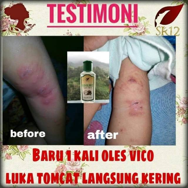 Vico oil