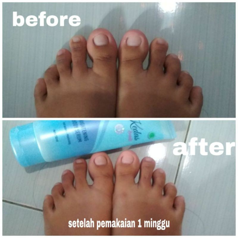 body serum
