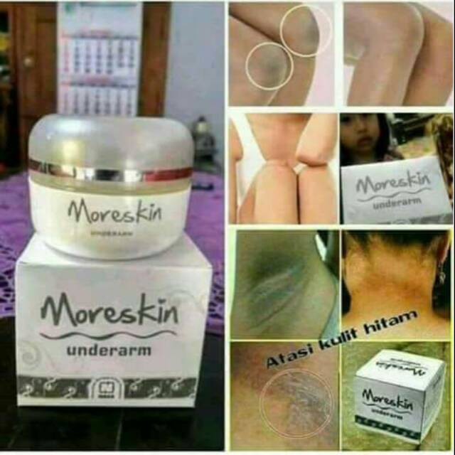 Moreskin underarm