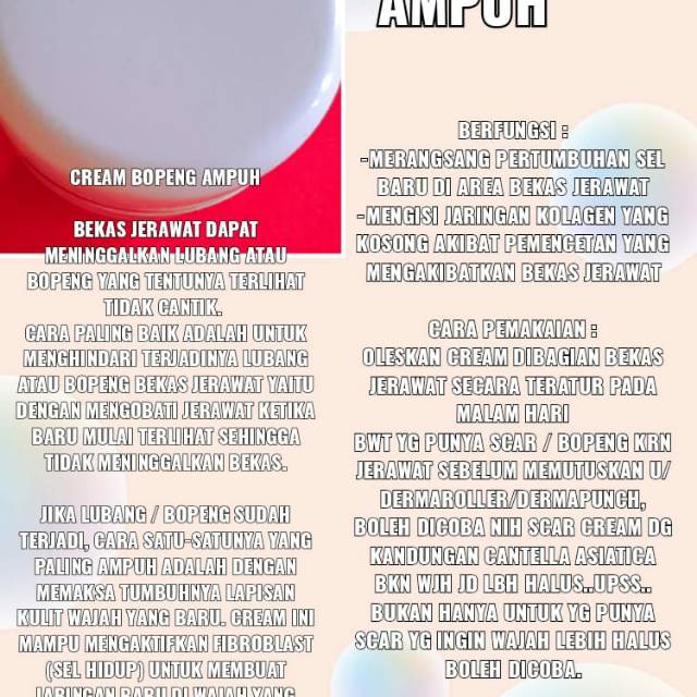 Cream bopeng ampuh