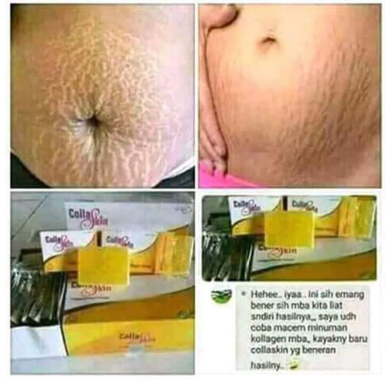Colla skin Nasa