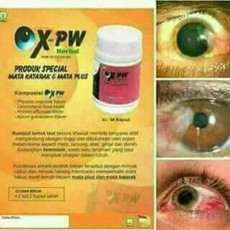 OX-PW Mata Katarak