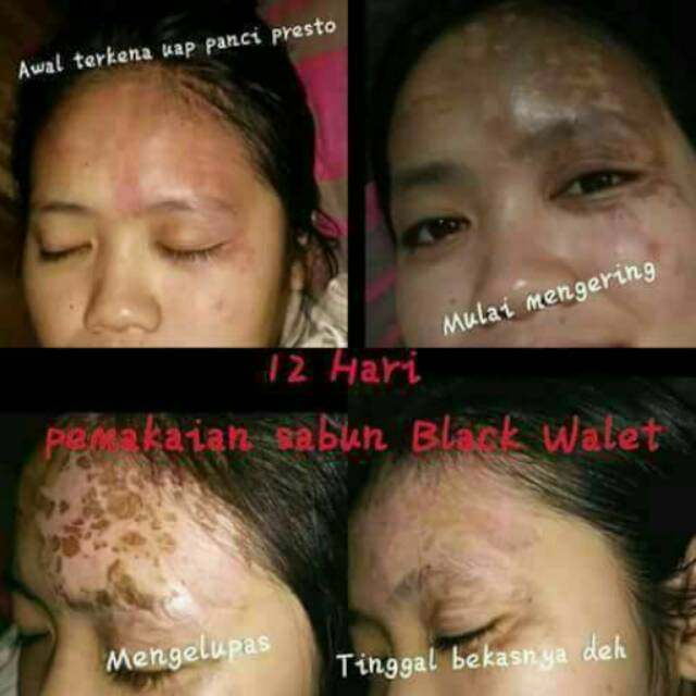 Black walet