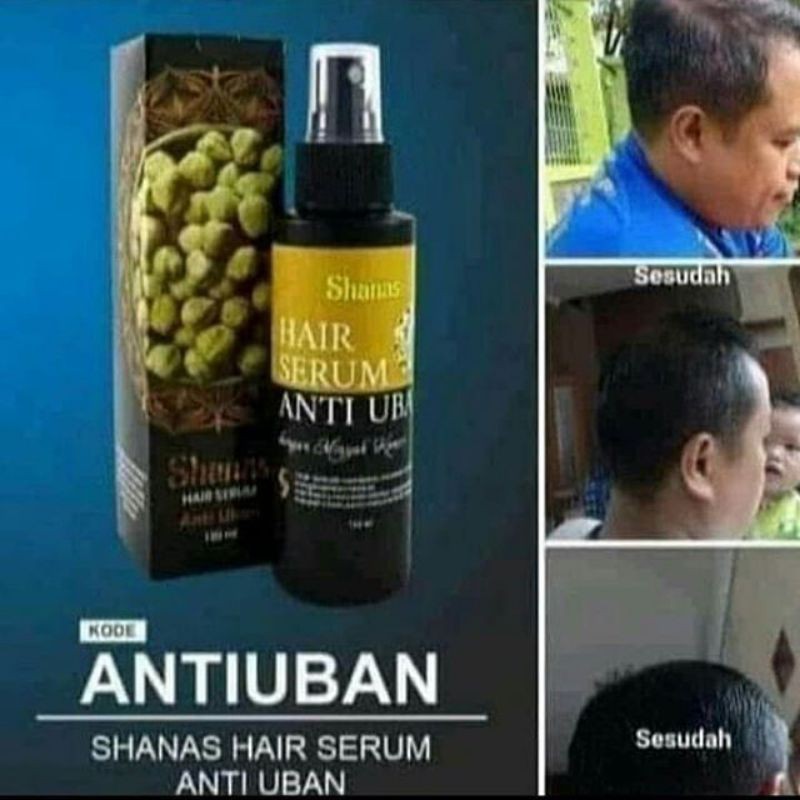 Serum AntiUban