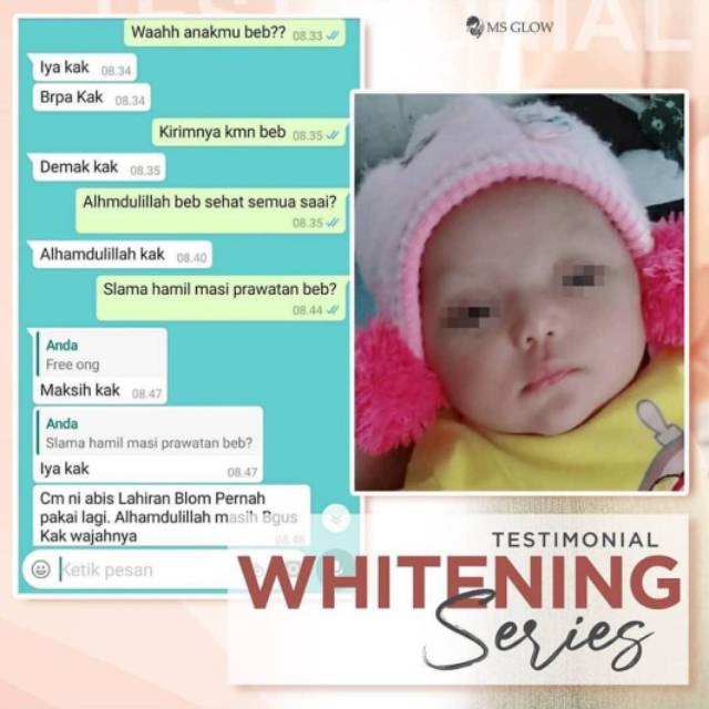 Paket whitening Ms Glow