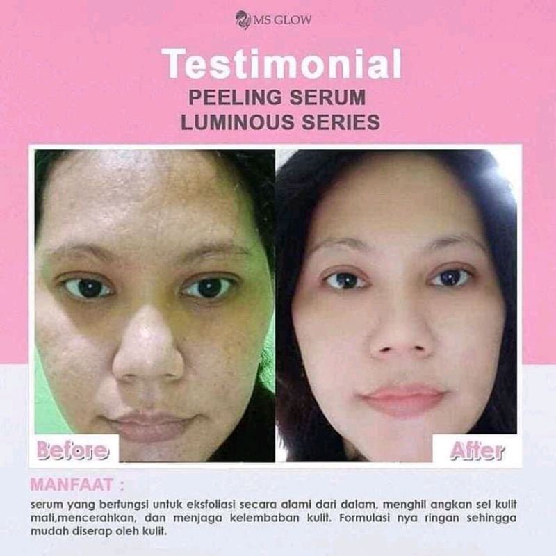 PEELING SERUM MS GLOW