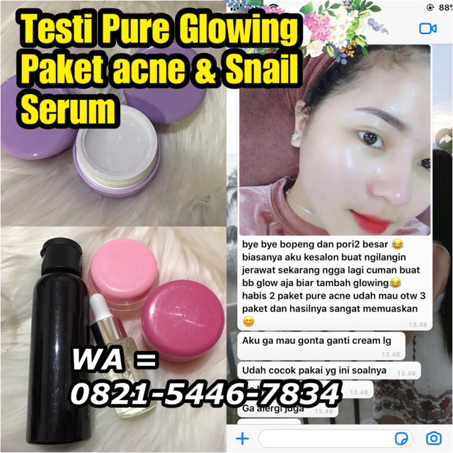 Penghilang jerawat