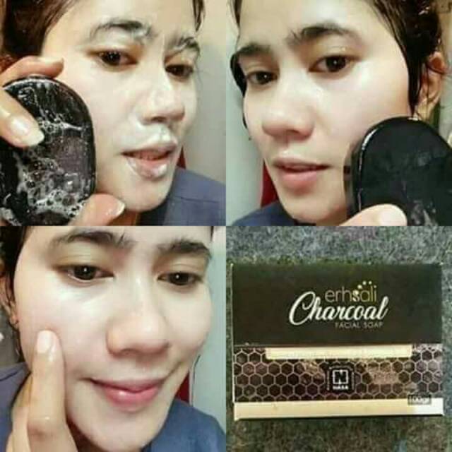 Charchol sabun jerawat