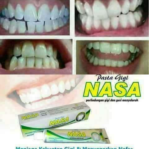 Pasta Gigi Nasa