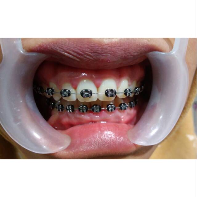 SAFIR ORTHO