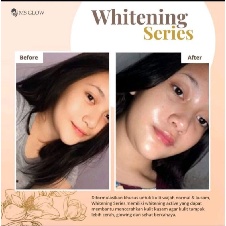 MS GLOW PAKET WAJAH