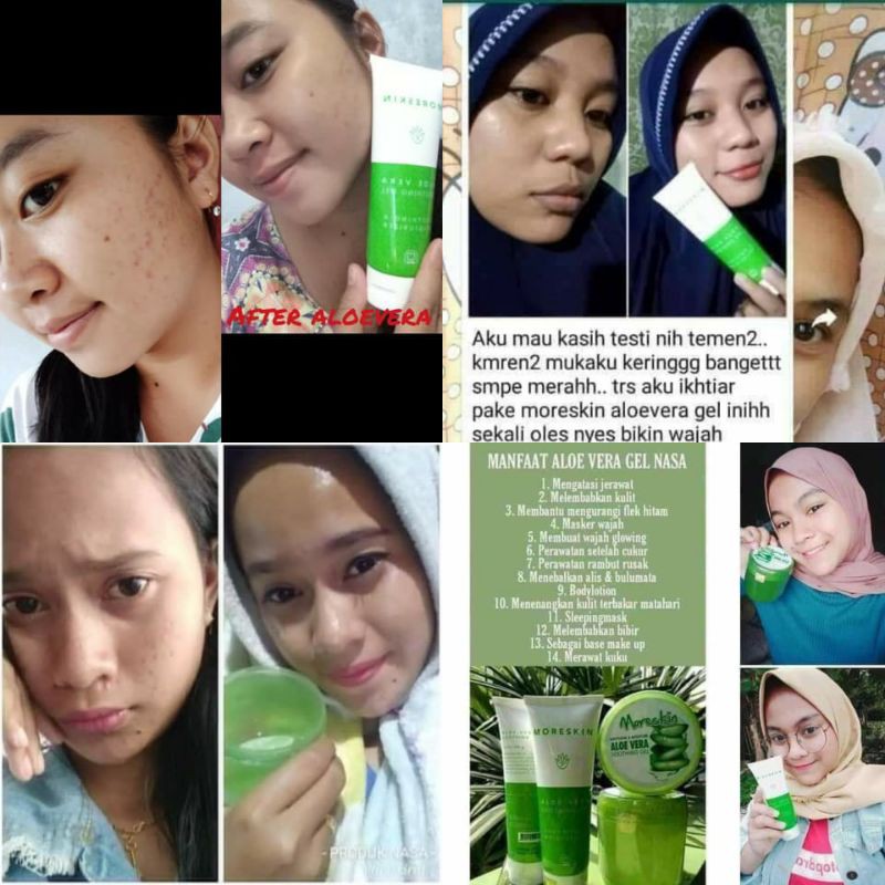 Aloe Vera gell Nasa