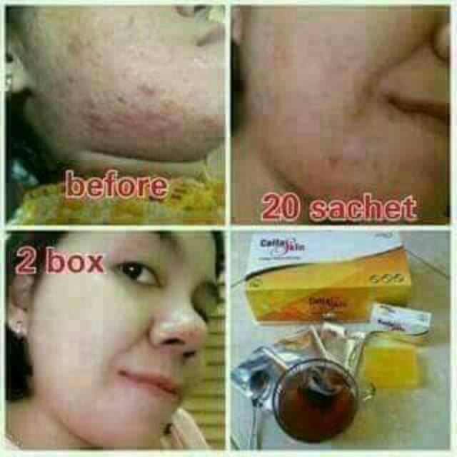 Collagen drink
