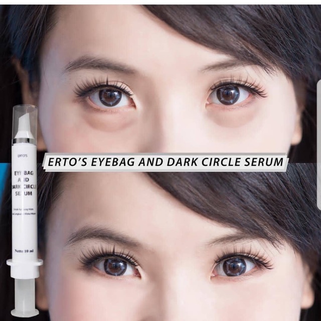 Ertos mata panda