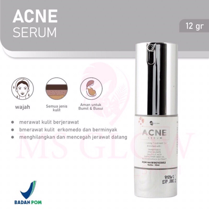 serum acne ms glow