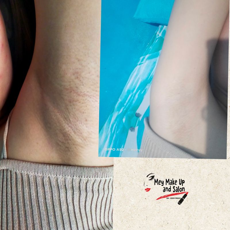 underarm cream
