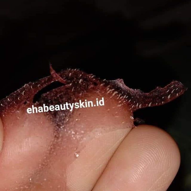 masker komedo
